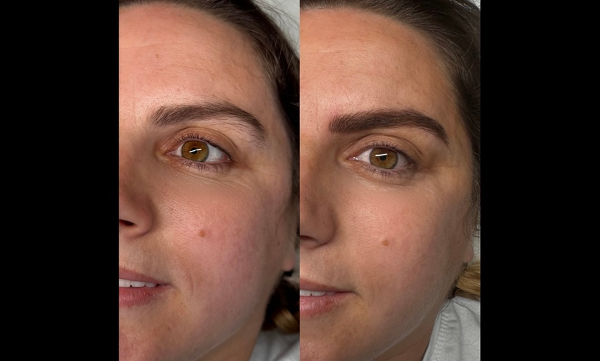 Image 8: Glow Up with One Microblading Session - Optional Top-Up Available
