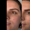Image 8: Glow Up with One Microblading Session - Optional Top-Up Available