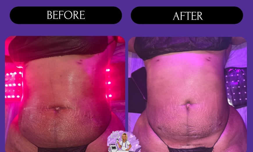 Image 6: 1 or 3 60-Min Lymphatic Drainage Massages with Optional Wood Therapy