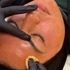 Image 1: Shed Sun Spots & Glow: VI Chemical Peel + Full Aftercare Kit