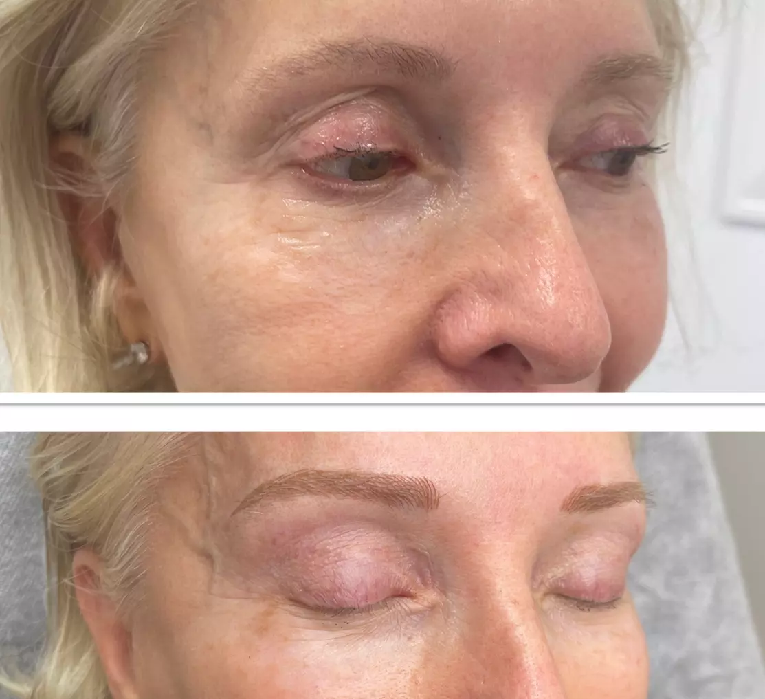 Up to 49% Off on Microblading at Shima Beaute