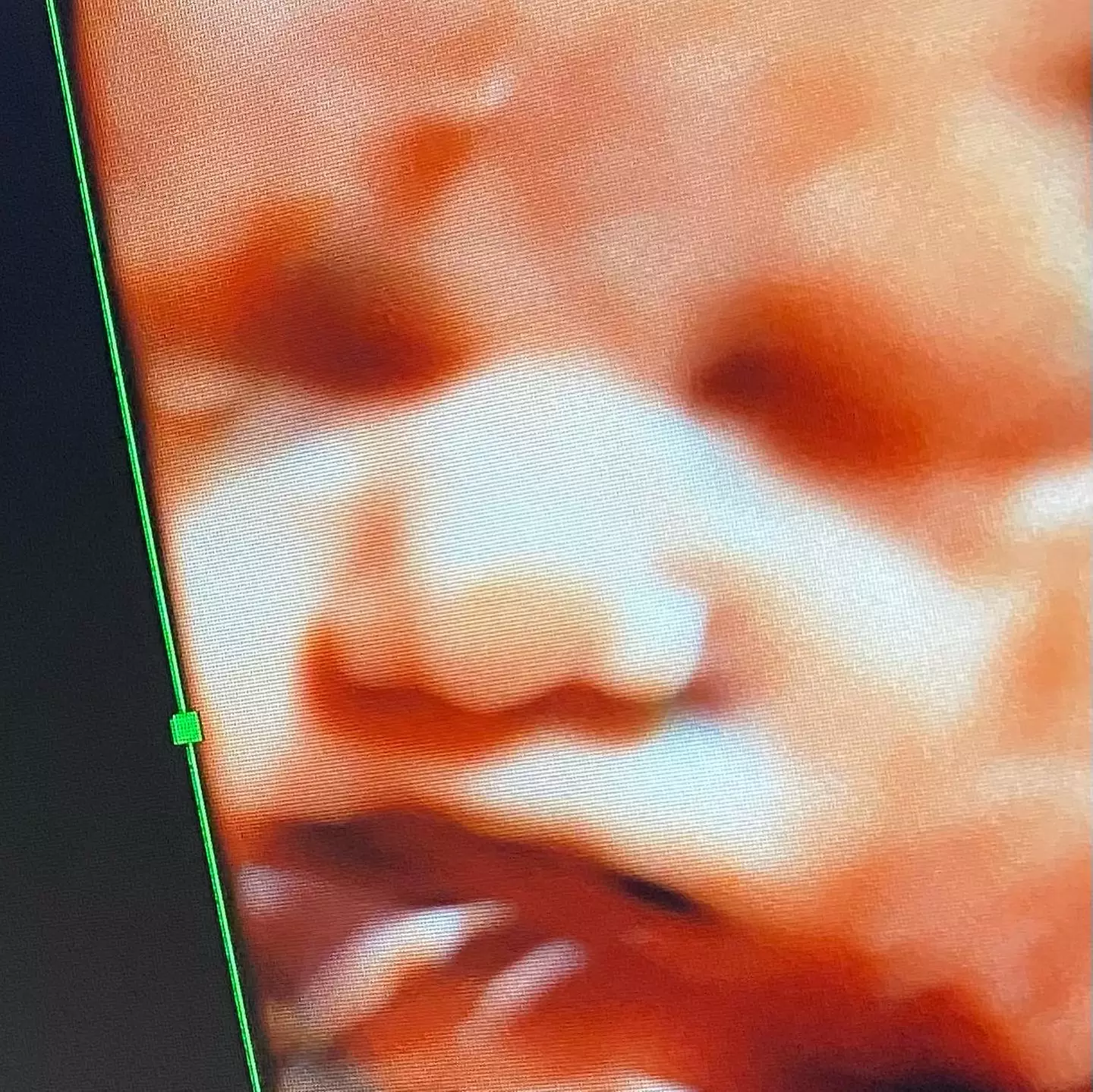 Up to 15% Off on Ultrasound - 3D / 4D at Babys First Impression - Primary Image