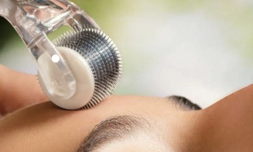 Image 6: IPL, Carbon Laser, RF Lifting or Micro-needling Facial Sessions