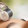 Image 6: IPL, Carbon Laser, RF Lifting or Micro-needling Facial Sessions