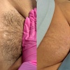Image 5: One, Three, Five, or Ten 30-Minute Brazilian/Bikini Waxing Sessions 