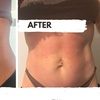 Image 5: Three, Six or Nine Sessions of VelaShape