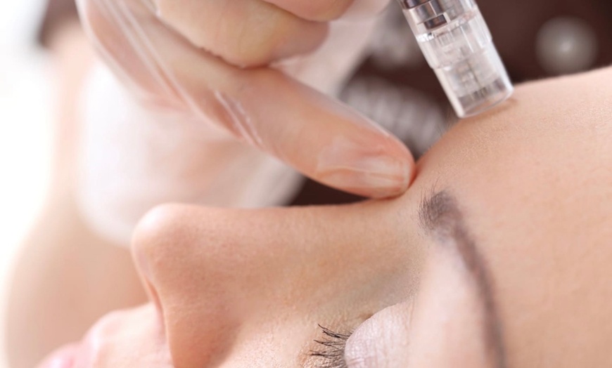 Image 6: One, Two, or Three Sessions: Hydrafacial with LED Therapy