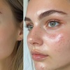 Image 1: Experience Radiant Skin: Chemical Peel