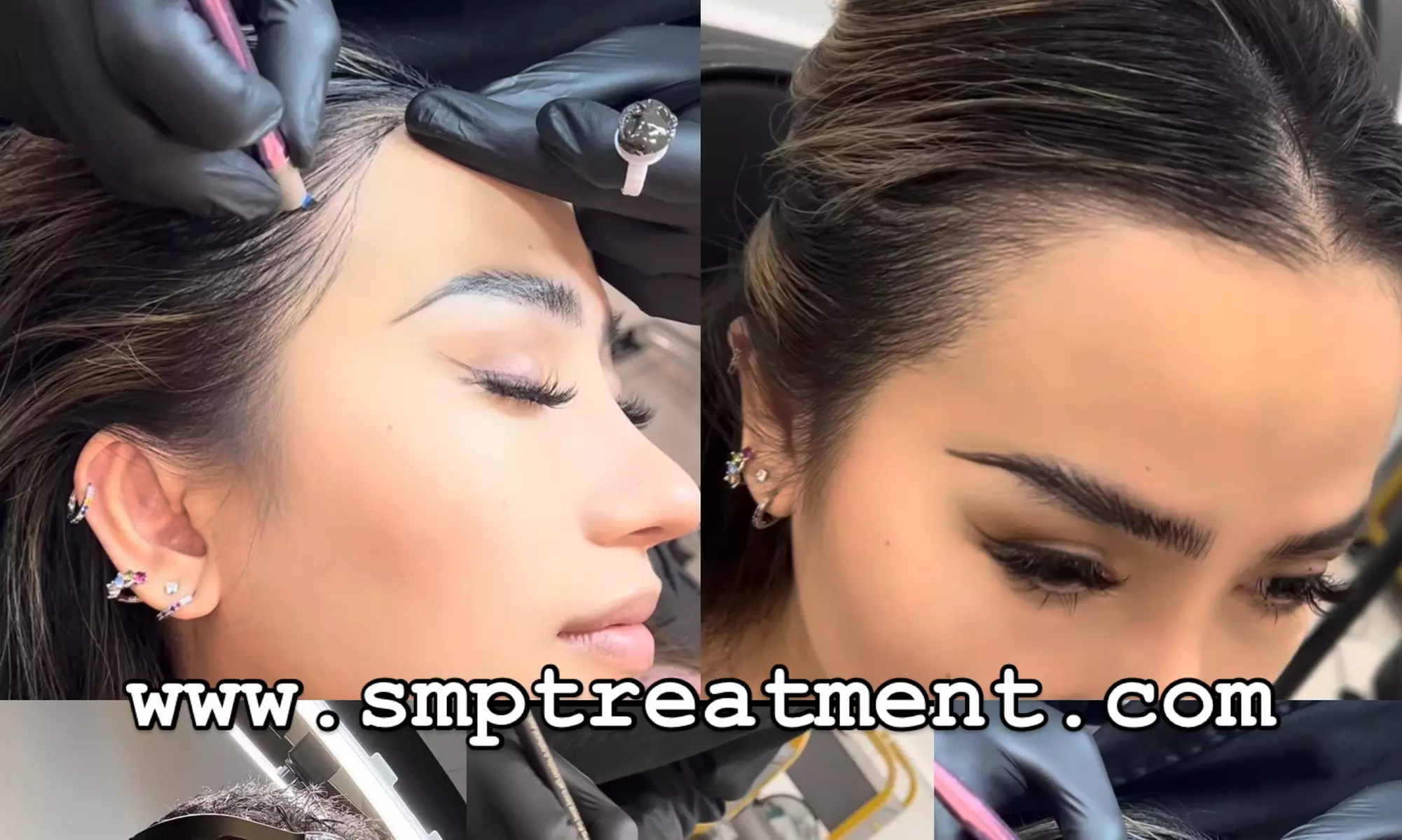 SMP Consultation w/ Hairline Focus, Density Boost for Hair Loss w/Care