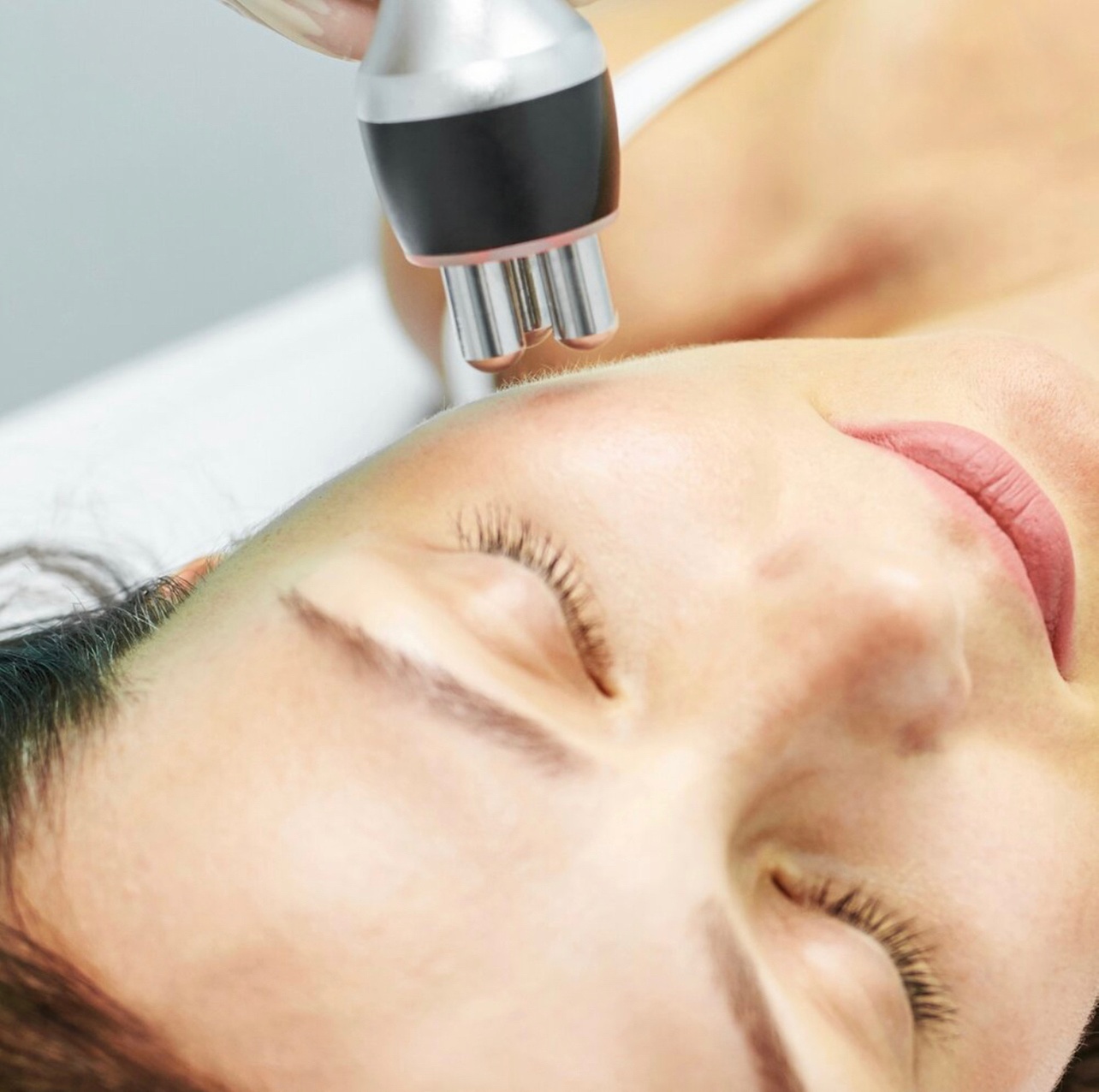 Experience Radio Frequency Skin Tightening Treatment Today