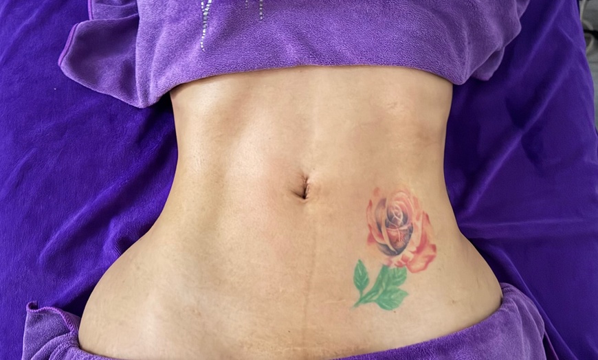 Image 6: 60-Min Lymphatic Drainage: Post-Op, Wellness, or Face/Chin Recovery