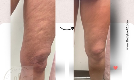 One Skin-Tightening Session for Stomach - The Body Lux