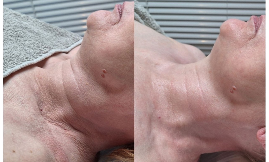 Image 2: Bis zu 35% Rabatt auf den Massage – Aromaöl bei Gym for skin Kosmetiksalon