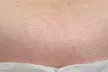 Up to 61% Off on Brazilian / Bikini Waxing at Touched By Tee Spa & Beauty LLC - Second Medium