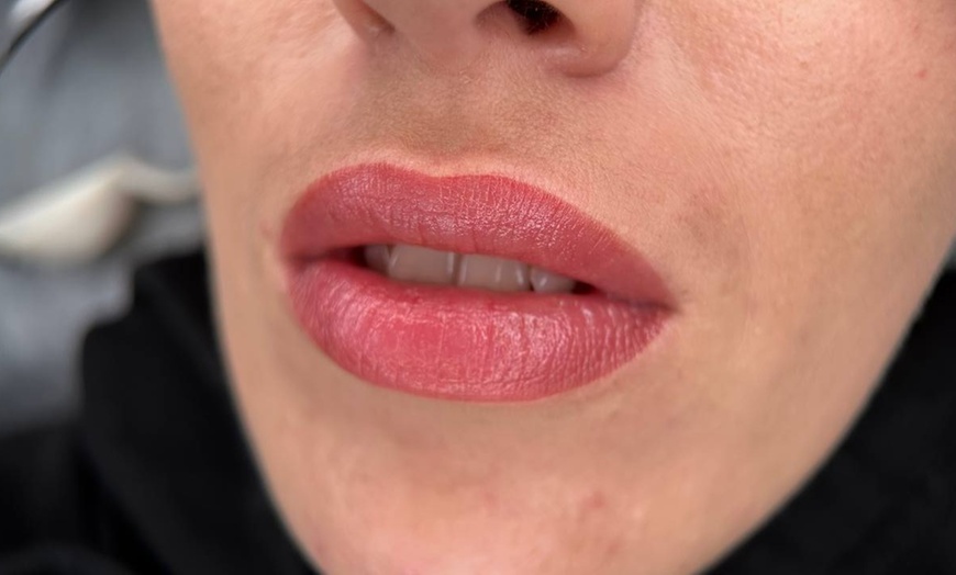 Image 2: Get Radiant Look with One Lip Blush or One Dark Lip Neutralisation 