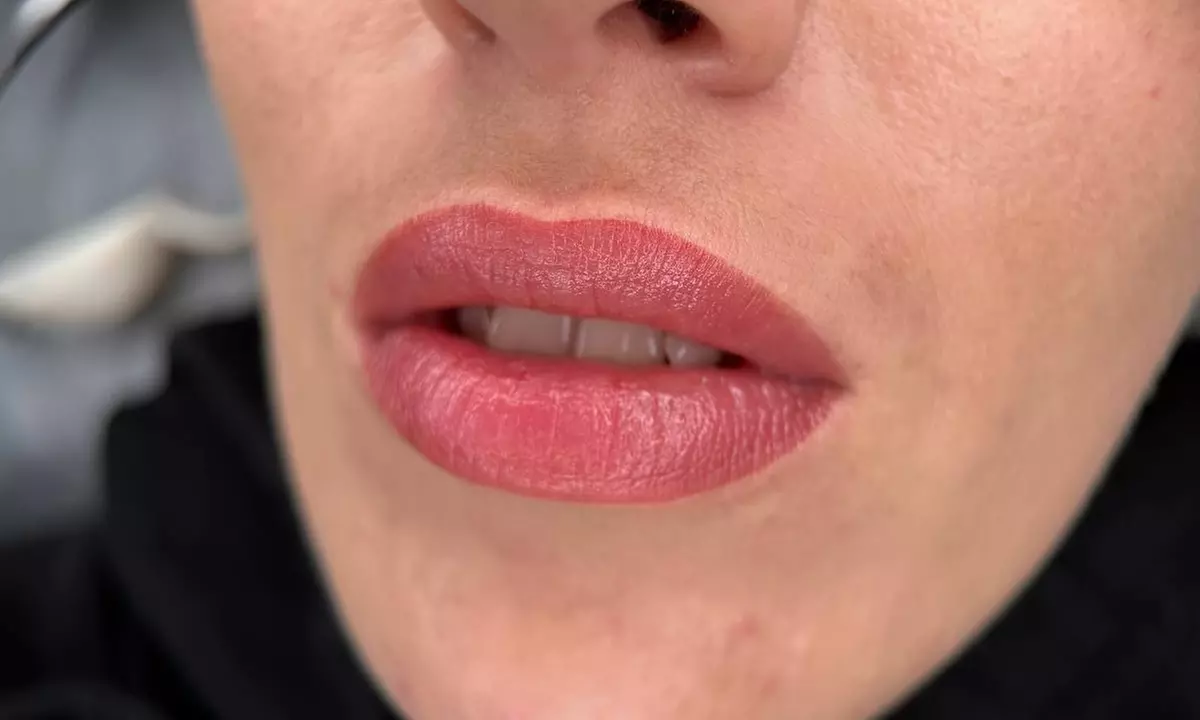 Get Radiant Look with One Lip Blush or One Dark Lip Neutralisation