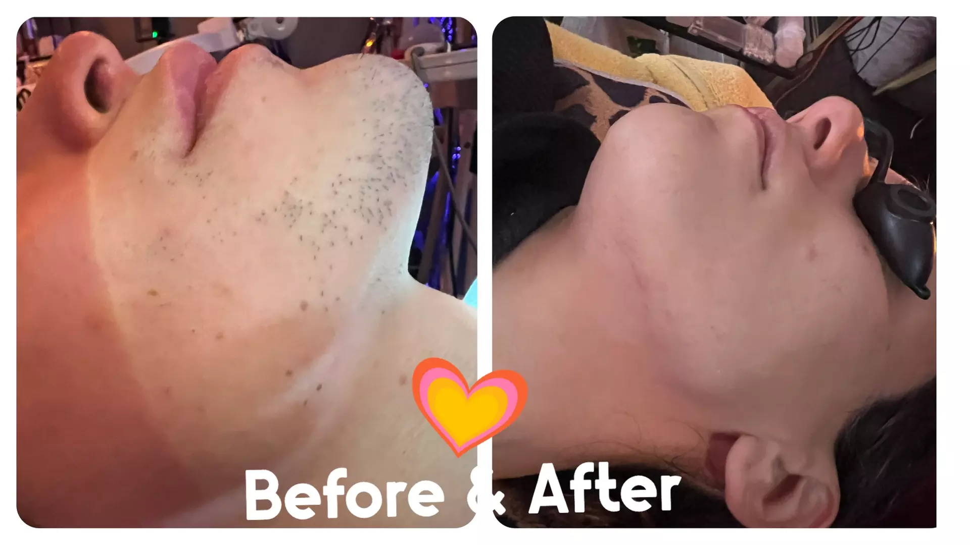 Up to 35% Off on Electrolysis at Esthetique Boutique