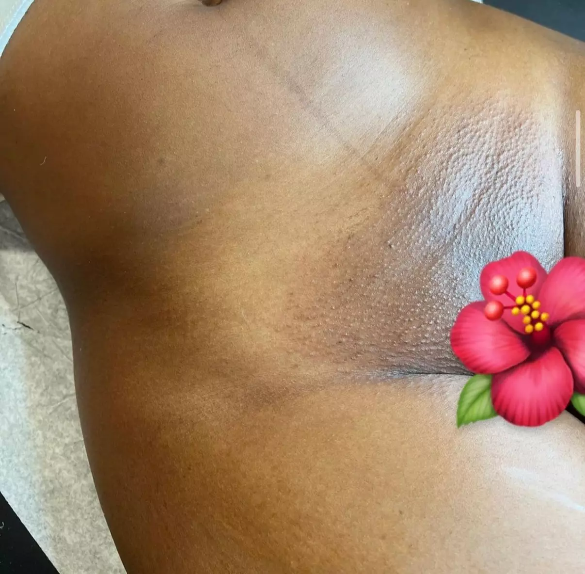 Transform Your Skin with 1, or 3 Brazilian Waxing Session