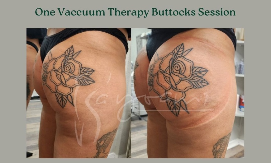 Image 6: Vacuum Therapy Buttocks & Body Enhancement or CryoStatic Slimming