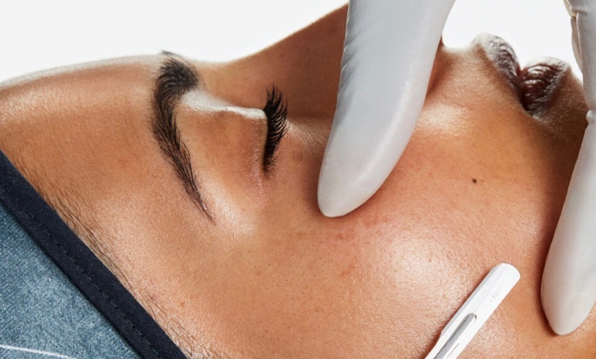 Image 1: Up to 35% Off on Anti-Aging Facial at Revive Skin Studio