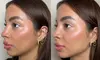 It's Time To Bring Your Youth Back w/ Botox under Expert Aestheticians at GlowVita MedSpa (Up to 52% Off)