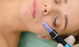 Revitalize Your Skin: One Microneedling with Optional PRP Treatment 