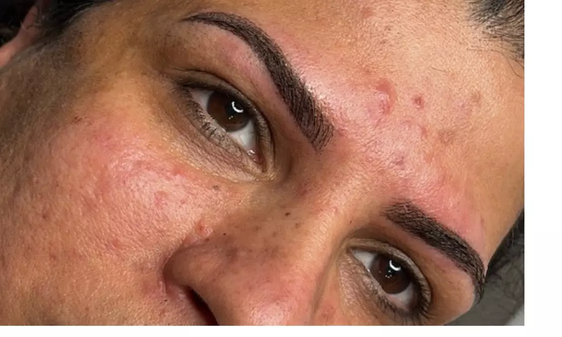 Flawless Brows: Combination Nano or Soft Ombre Powder Eyebrows