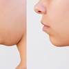Image 1: Up to 53% Off on Double Chin Injection at Lov Med Spa