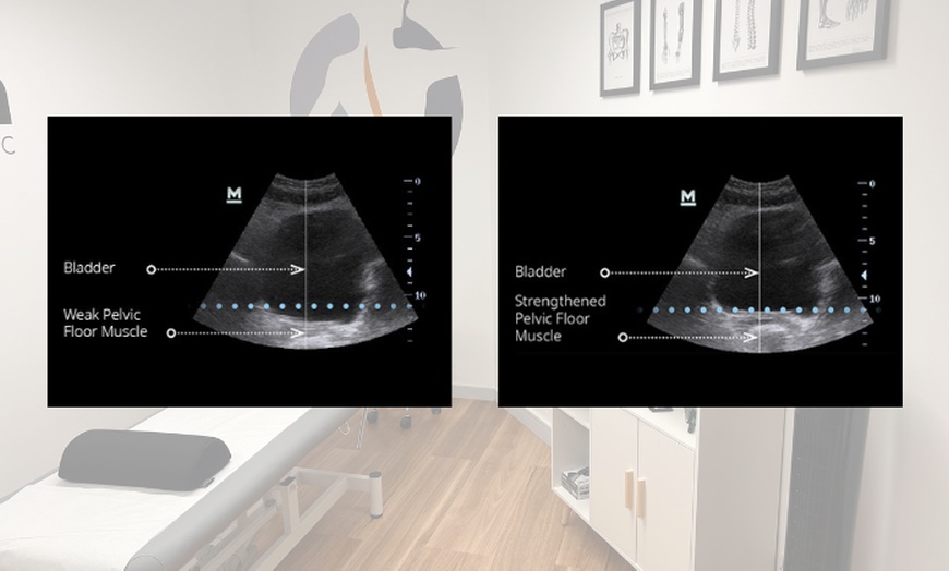 Image 4: Men OR Women: One Pelvic Floor Strengthening Chair Treatment 