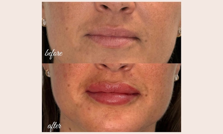 Image 7: Defined Brows & Lips with Microblading or Lip Blush