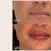 Image 7: Defined Brows & Lips with Microblading or Lip Blush