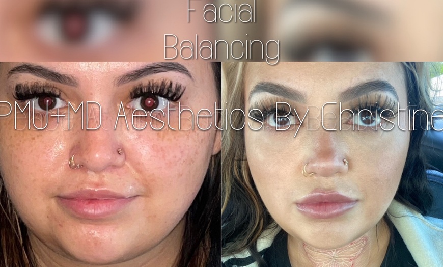 Image 6: Up to 43% Off on Injection-Organic Filler at PMU+MD AESTHETICS