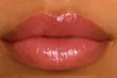 Up to 45% Off on Lip Enhancement at Blaké Aesthetics - Second Medium