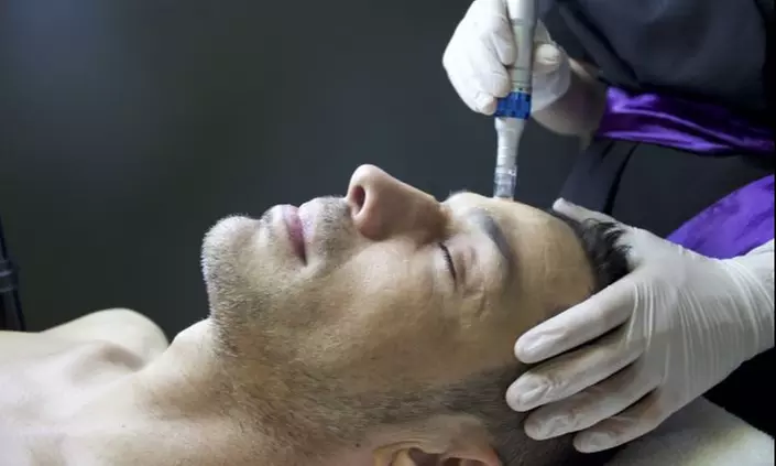 Up to 60% Off on Micro-Needling with PRP Platelet Rich Plasma at EternaMD