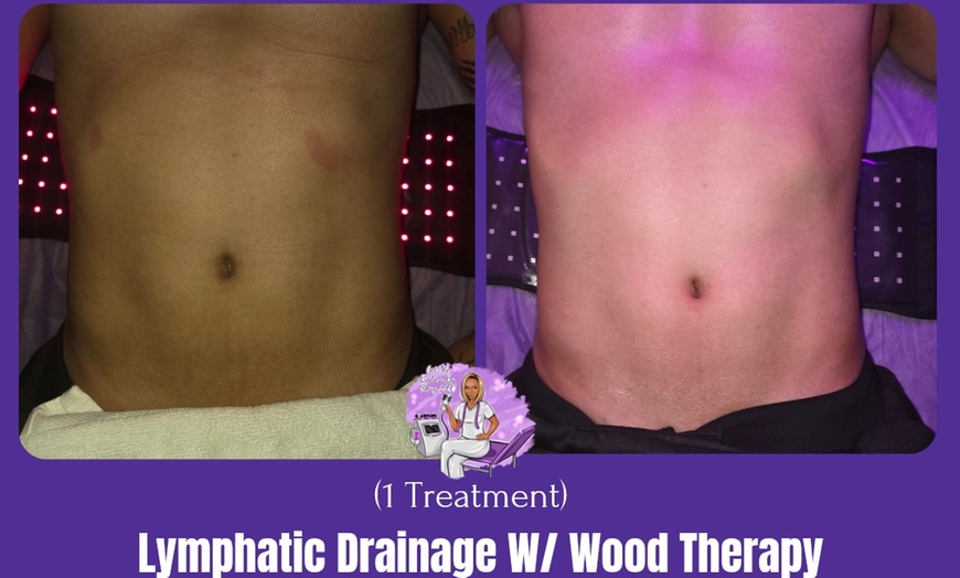 Image 5: Post-Op Support Lymphatic Drainage Massage 