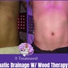 Image 5: Post-Op Support Lymphatic Drainage Massage 
