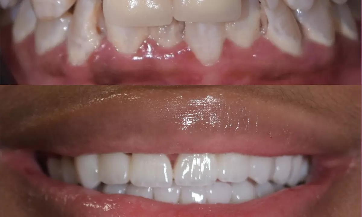 Dental Crowns, Dental Exam, X-rays & Cleaning, Dentures & More