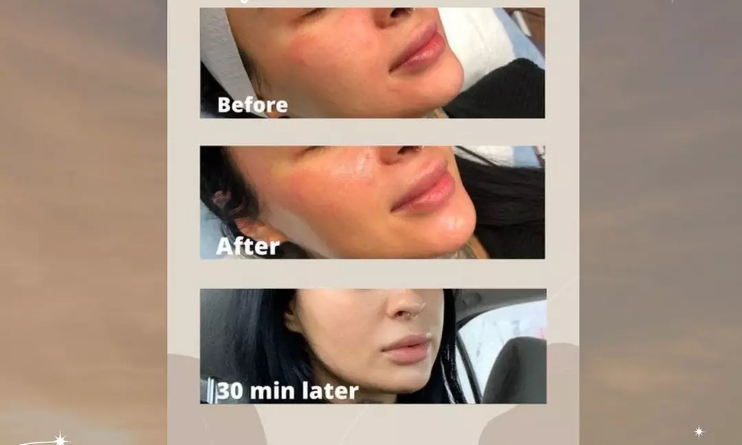 Up to 59% Off on Anti-Aging Facial at Laser & Organic Spa