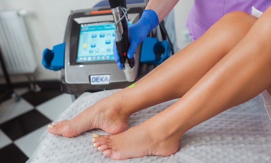 Image 3: Bis zu 60% Rabatt auf den Laser-Haarentfernung bei D Derma Aesthetics