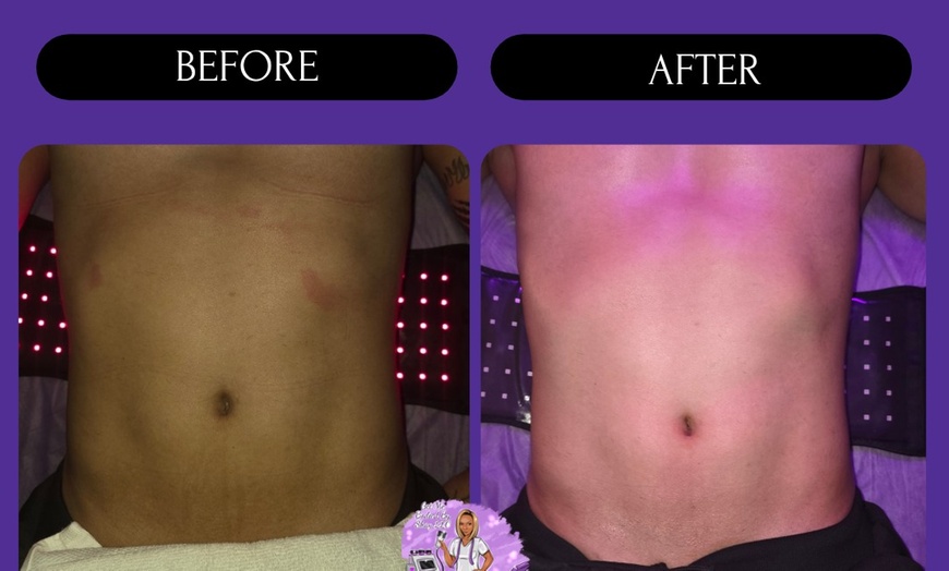 Image 7: 1 or 3 60-Min Lymphatic Drainage Massages with Optional Wood Therapy