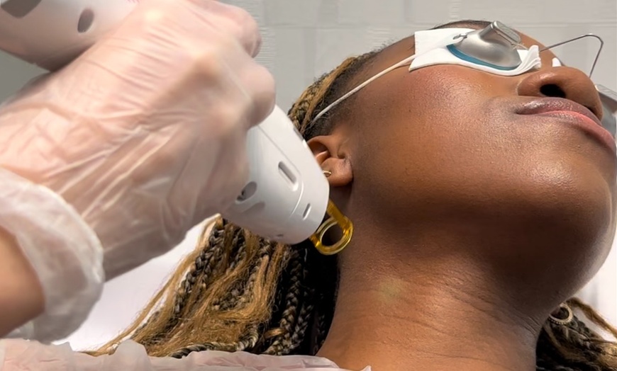 Image 4: Up to 50% Off on Laser Skin Resurfacing at Laser Spot Nyc