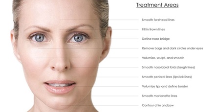 One syringe of dermal filler (i.e. Revanesse Versa) for the LIPS - MelCV Health & Beauty