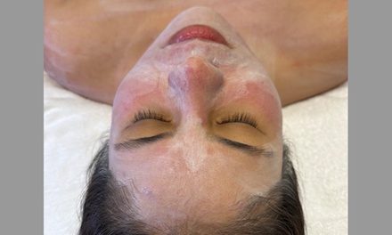 Pharmaceutical Grade Vitamin A-Chemical Peel with Custom Facial Treatment - Amy Nicols Aesthetics