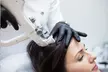 1, 2, or 3 Exosome Stem Cell or Advanced Hair Restoration Therapy with Thulium RF & Mesotherapy (Up to 40% Off) - Second Medium