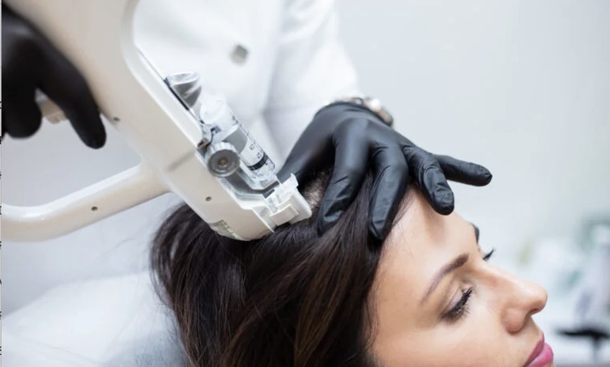 Image 2: 1, 2, or 3 Exosome Stem Cell or Hair Restoration w/ Thulium RF & More