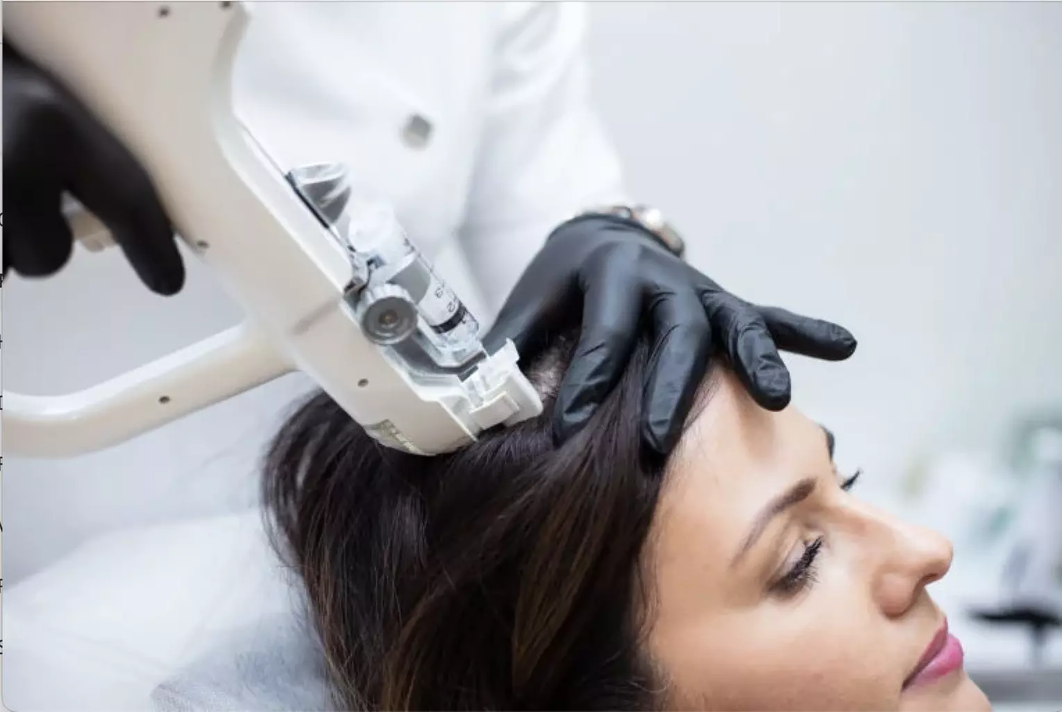 1, 2, or 3 Exosome Stem Cell or Hair Restoration w/ Thulium RF & More