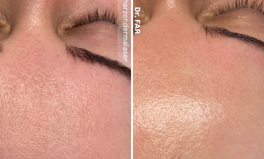 Image 1: 45-75 Min. After Holiday Glow & Serum-Therapie