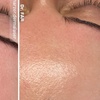 Image 1: 45-75 Min. After Holiday Glow & Serum-Therapie
