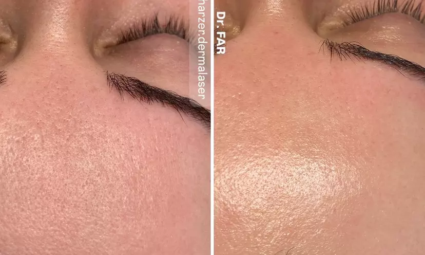 45-65 Min. After Holiday Glow & Serum-Therapie