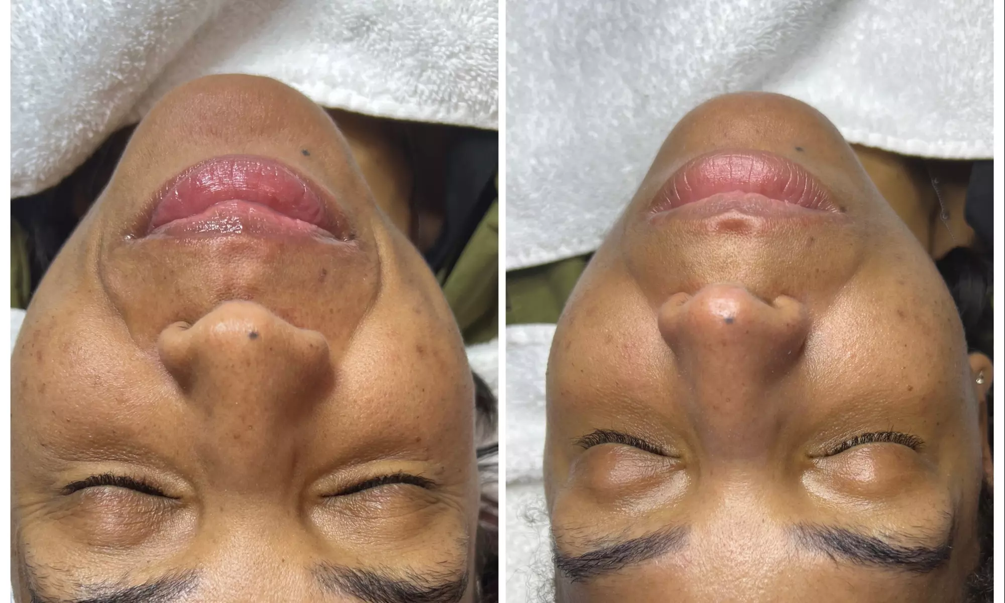Up to 41% Off on Facial at Penthouse Beaute - Primary Image